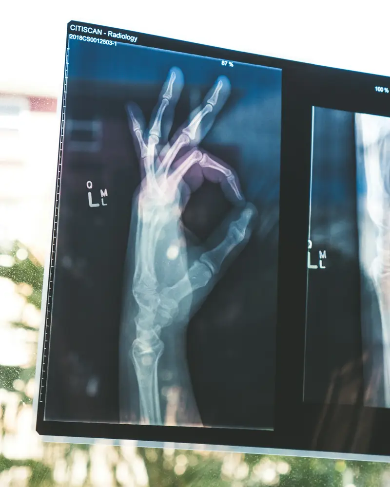 X-ray images on a light board